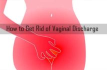 vaginal white discharge